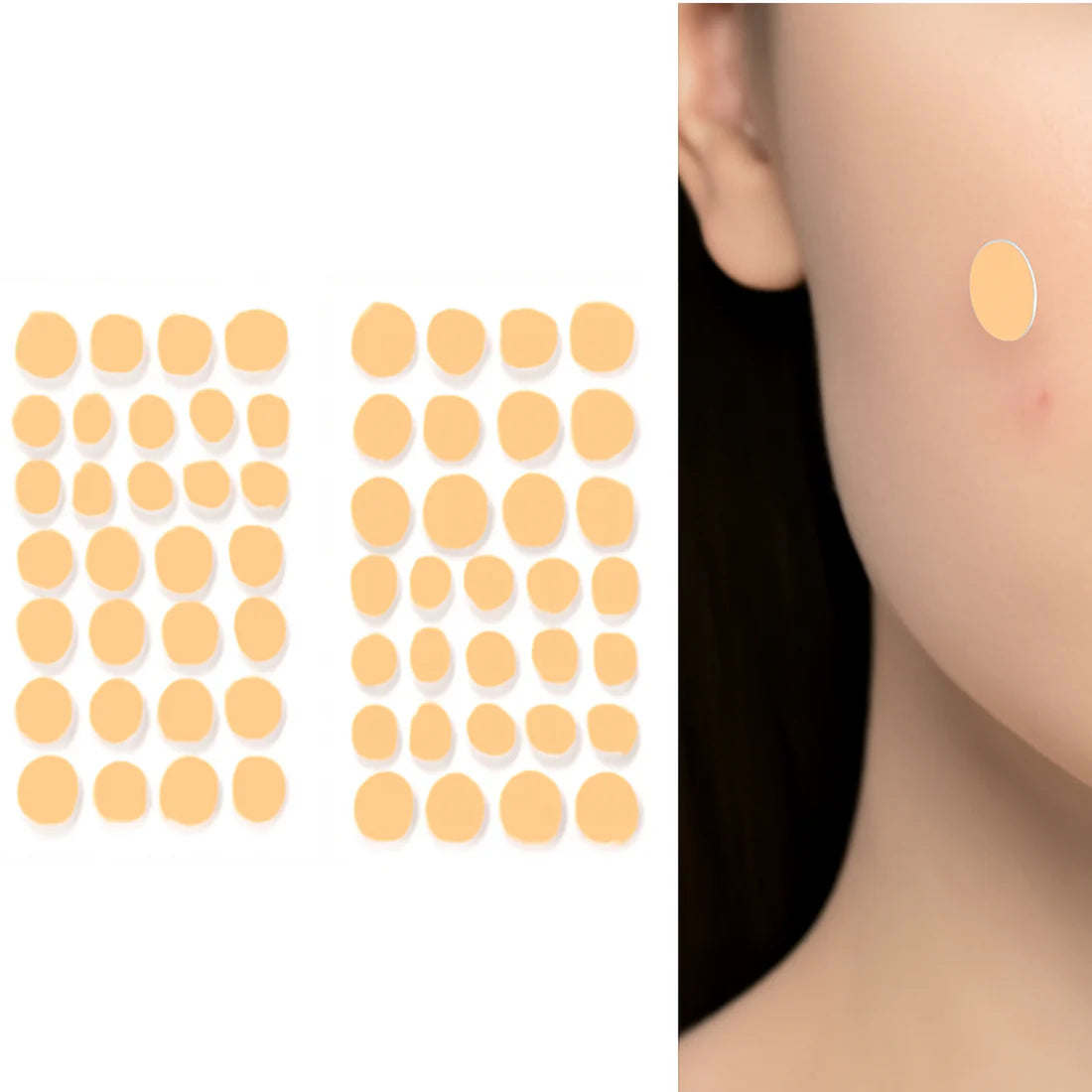Pimple Patches – Hydrocolloid & Tea Tree Oil for Acne