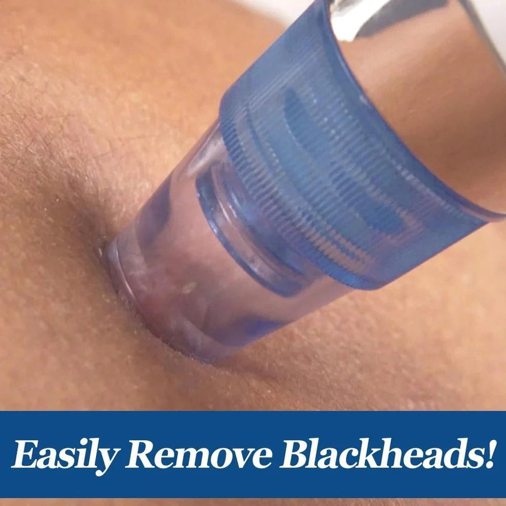 Blackhead Remover – 4-in-1 Vacuum Suction Pore Cleaner